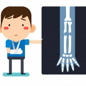 MEDIDAS DE PREVENCIÓN PARA EVITAR ACCIDENTES