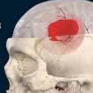 Aphasia Activity