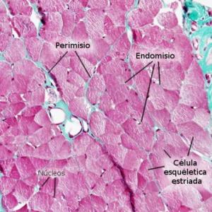 Tejido muscular