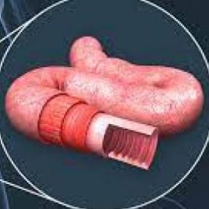 Intestino delgado