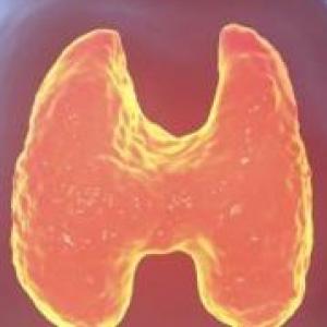 Hipotiroidismo-Nódulo Tiroideo-Cáncer Tiroideo