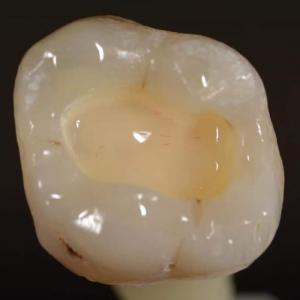 Imagen de portada del videojuego educativo: Memoria: Biomateriales dentales, de la temática Salud