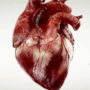 Arritmias Cardiacas