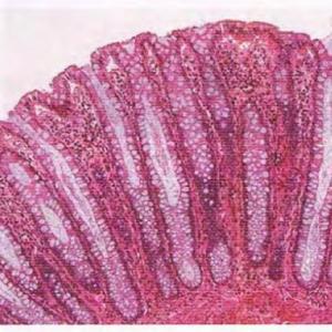 Tejido glandular