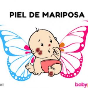 PIEL DE MARIPOSA
