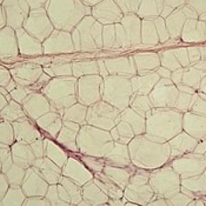 Tejido Adiposo 2