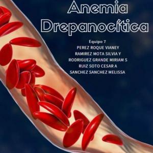 ¿Qué Tanto Sabes Acerca La Anemia Drepanocítica?