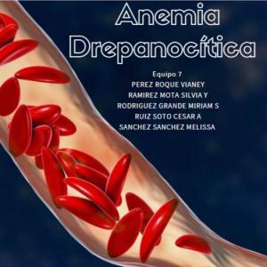 ¿Qué Tanto Sabes Acerca La Anemia Drepanocítica?