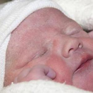 Evaluación del Neonato