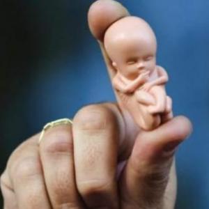 AFECTACIONES FISICAS Y PSICOLOGICAS DEL ABORTO EN LOS ADOLESCENTES