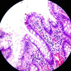 Epitelio glandular