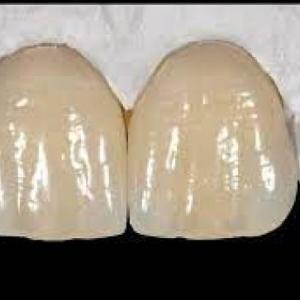 TRATAMIENTOS DENTALES