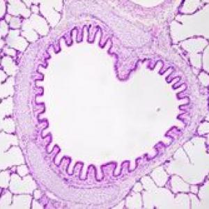 TEJIDO GLANDULAR "Las histológas"