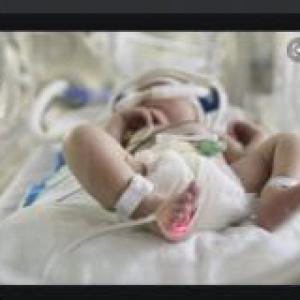 Enfermería del neonato