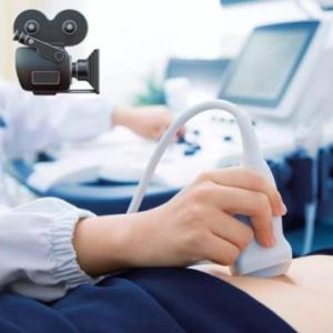 Videos ultrasonido de ovario