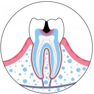 Complejo dentino pulpar II. Pulpa