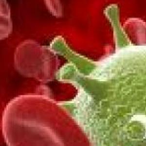 Prueba tus conocimientos sobre Sepsis