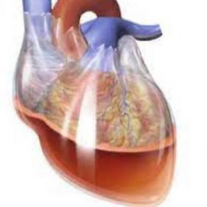 TAPONAMIENTO CARDIACO
