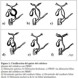 Obstrucción Intestinal y Duodenal