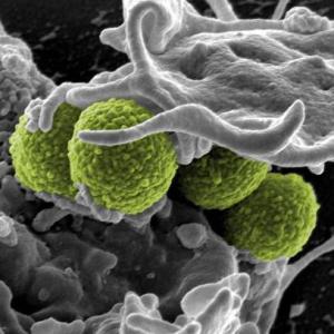 Cadena epidemiológica