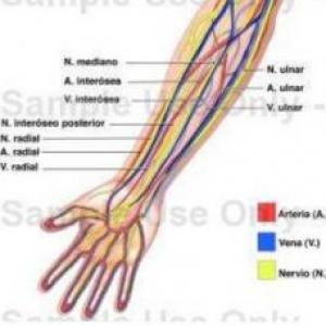 Diabetes Mellitus