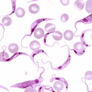 TRYPANOSOMA CRUZI: Enfermedad del Chagas