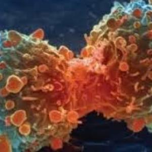 Carcinogénesis