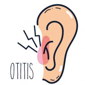 Síntomas de la otitis