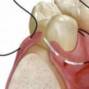 Terminilogia