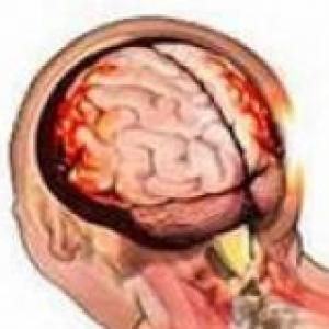 CRANIOENCEPHALIC TRAUMA