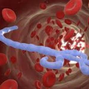 EBOLA