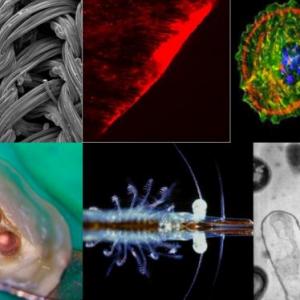 Imágenes en el microscopio