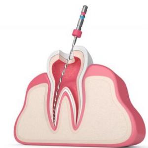 Variaciónes anatomicas de las piezas dentales