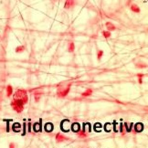 Tejido conectivo