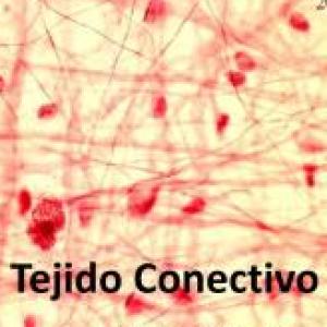 Tejido conectivo