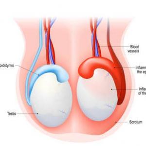 EXAMEN TESTICULAR