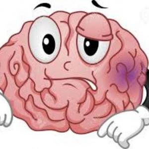 Trivia brain