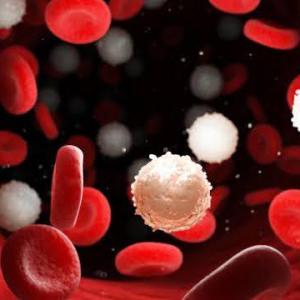 La leucemia
