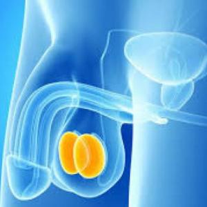 ORQUIDOPEXIA Y ORQUIDECTOMÍA