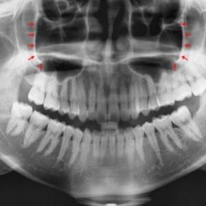 imágenes diagnosticas.