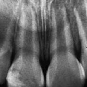 imágenes diagnosticas.
