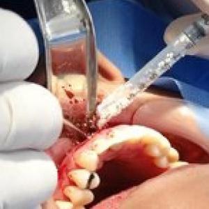 Terminología medica en Cirugía Bucal