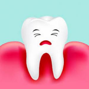 la gingivitis