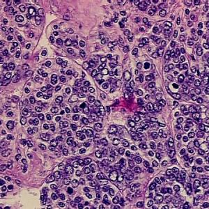 TEJIDO SANGUINEO Y HEMATOPOYESIS