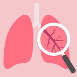 Cáncer pulmonar/COVID-19