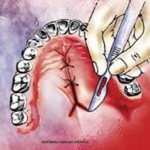 Terminologia en Cirugia bucal