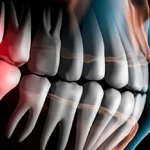 Terminologia en Cirugia Bucal