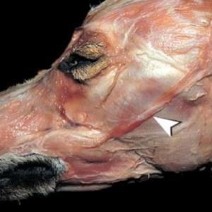 Músculos de la cabeza