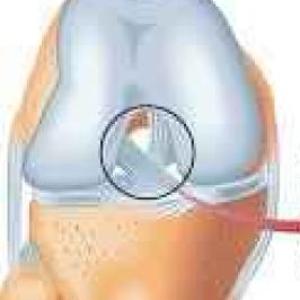 Ligamentos y tendones