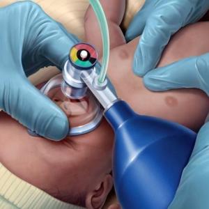 Portada del juego Generalidades de la reanimación neonatal – Salud